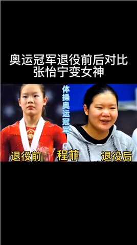 有种整容叫奥运冠军退役前后对比，张怡宁变女神，变化太大了