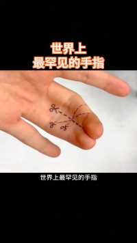 世界上最罕见的手指
