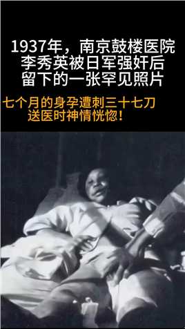  1937年，南京鼓楼医院，李秀英被日军强奸后，留下的一张罕见老照片，镜头中的她躺在病床上，因为刚刚经历了劫后余生
