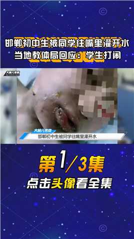 邯郸初中生被同学往嘴里灌开水，当地教体局回应：学生打闹时烫伤 (1)