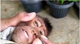 小猴鼻孔里惊现蚂蟥，小伙及时发现，让它捡回一条小命