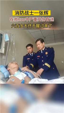 28岁的消防战士张辉，在救huo中严重受伤昏迷，600多天翘首以盼，终于醒过来了！#传递正能量#致敬英雄#泪目