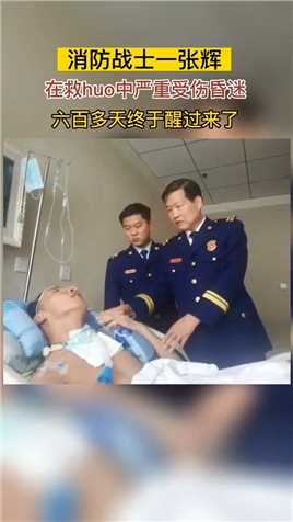 28岁的消防战士张辉，在救huo中严重受伤昏迷，600多天翘首以盼，终于醒过来了！