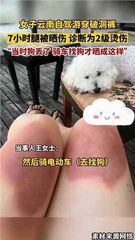 女子云南自驾游穿破洞裤，7小时腿被晒伤，诊断为2级烫伤。