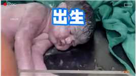 刚出生的小婴儿却没有呼吸，这可把产房里的医护人员急坏了#刚刚出生的小宝宝 #坚强的小生命 #产房故事 #人类幼崽 #新生儿
