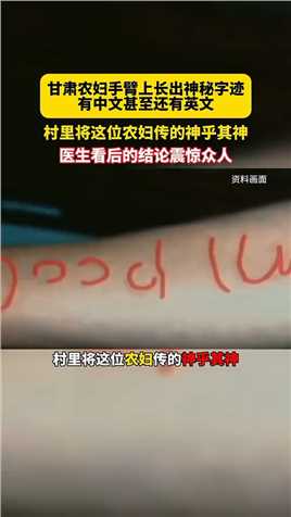 农妇手臂上长出神秘字迹，有中文，有英文，医生看后的结论震惊众人！