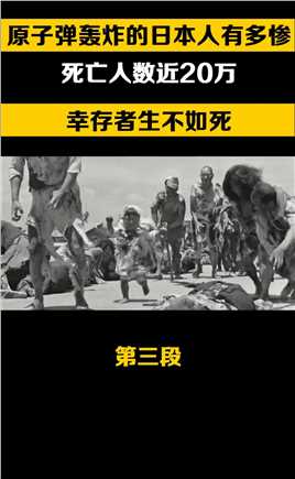 原子弹轰炸的日本人到底有多惨，死亡人数近20万，幸存者生不如死历史原子弹轰炸日本日本投降战争 (3)