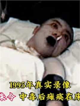 1995年真实录像，朱令中毒后瘫痪在床痛苦不堪，铊检测超标上万倍