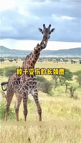 脖子受伤的长颈鹿,一路走来太不容易了,长颈鹿,动物世界