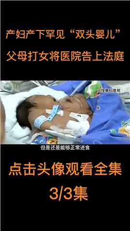 女子产检一切正常，却生下罕见双头婴儿一怒之下将医院告上法庭 (3)