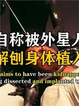 湖南男子自称被外星人劫持，还被解刨身体植入芯片，专家：他没有说谎！#记录 #外星人 #揭秘 #奇闻趣事.