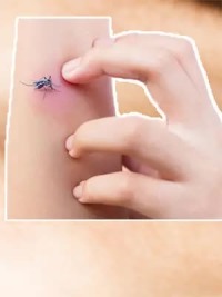 为什么蚊子更喜欢叮你？是因为血型特殊，还是新陈代谢率更高呢