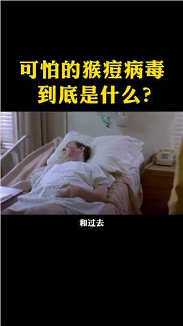香港出现了首个猴痘病例，猴痘病毒到底是什么？