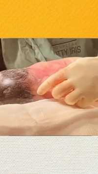 宝宝和羊膜囊一起诞生，真是太神奇了！