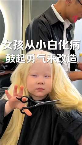 女孩从小得了白化病，终于鼓起勇气来改造，发型师也激励着女孩，与女孩一起染头发，小女孩也太美了吧 