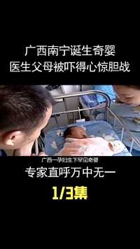 广西南宁诞生奇婴，医生父母被吓得心惊胆战，专家直呼万中无一！ (1)