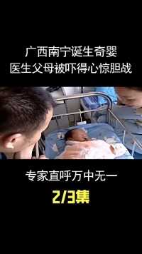 广西南宁诞生奇婴，医生父母被吓得心惊胆战，专家直呼万中无一！ (2)