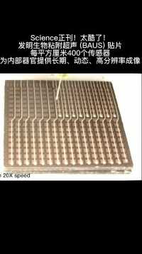 Science正刊！太酷了！华人科学家发明生物粘附超声(BAUS)贴片，每平方厘米400个传感器，为内部器官提供长期、动态、高分辨率成像