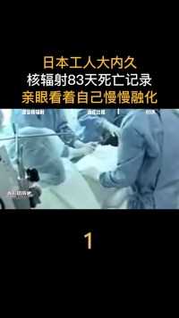 日本工人大内久：核辐射83天死亡记录，亲眼看着自己慢慢融化#核辐射#大内久#日本核辐射#真实事件 (1)