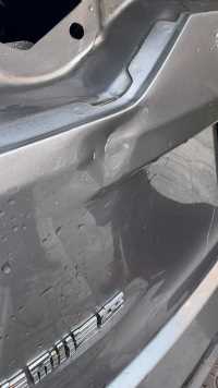 神奇的凹陷修复