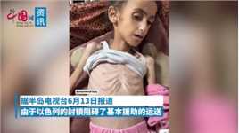 因以色列阻挠援助，加沙8岁女孩被活活饿死：曾面颊饱满 活泼可爱