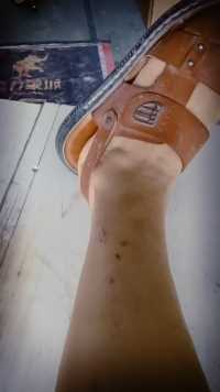 吸血的蚊子#微视上热门