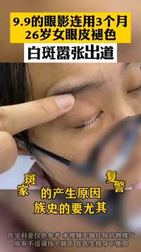 女子因贪图一时小便宜 导致白癜风缠身 生活中一定要多注意