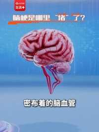 脑梗致残、致死率极高，它是怎么发生的？北京大学第一医院副院长李建平带你一探究竟（央视频号：全民健康大会）
