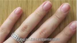 为啥有的人指甲会出现竖纹，它暗示着什么？