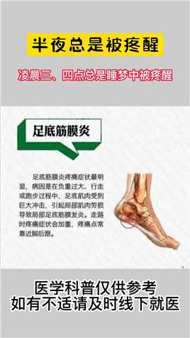 #骨科 #中医 多关节疼痛脚后跟疼痛，可能是他在作祟!—定要注意!#筋膜炎 #医学科普 