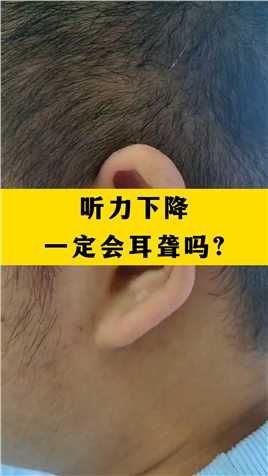 听力下降一定会耳聋吗?#耳鸣 ##中医 ##健康 