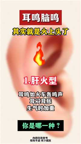 耳鸣脑鸣就是上火了 #耳鸣#中医##健康 