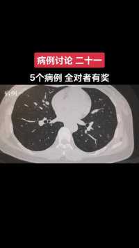 #医学影像 #呼吸影像 #呼吸影像病例讨论 #肺结节 #虞言虞语