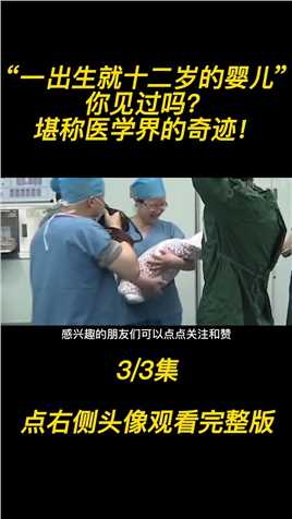 “一出生就十二岁的婴儿”，你见过吗？堪称医学界的奇迹！医学奇迹孕育胎儿迎接新生命 (3)