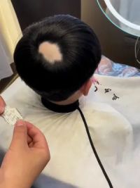 这也许是孩子最开心的事了吧，因为自卑不去学校，希望以后不会因为头发而带来压力#北京立尔美假发定制 #斑秃补发贴片