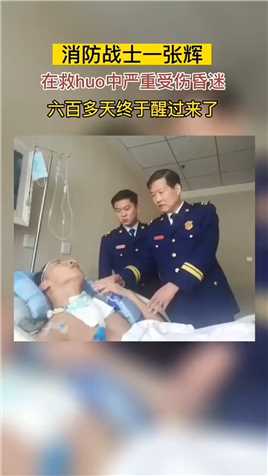 28岁的消防战士张辉，在救huo中严重受伤昏迷，600多天翘