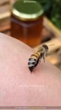 蜜蜂蜇人还会活下来吗？
