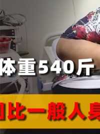 23岁小伙体重540斤，腰围高达1米9，睡觉连呼吸都能暂停500多次#肥胖#减肥#呼吸#合理饮食