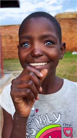 这个非洲女孩有着一双漂亮的蓝眼睛