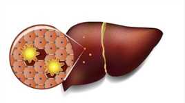 肝脏是人体最“沉默”的器官，这6种肝病很常见，提早预防是关键