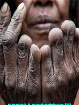 印尼达尼部落的结婚习俗，男人想要结婚彩礼就是自己左手的食指。