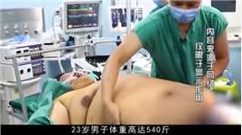 23岁小伙体重540斤，睡觉窒息509次，医生切开后惊呆了#体重#减肥#真实事件 (2)