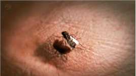 你知道蚊子是怎么吸血的吗？
