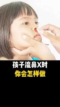 孩子流鼻血时，你知道正确的做法吗？