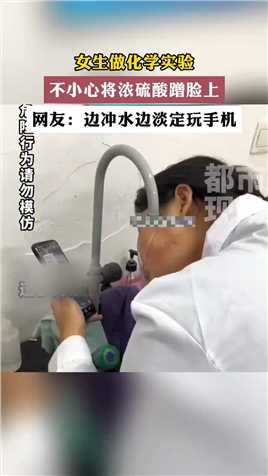 女生做化学实验不小心将浓硫酸蹭脸上