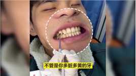 别人嫌你牙齿黑黄，嘴巴不好闻，为什么不试试这款益生菌牙膏！